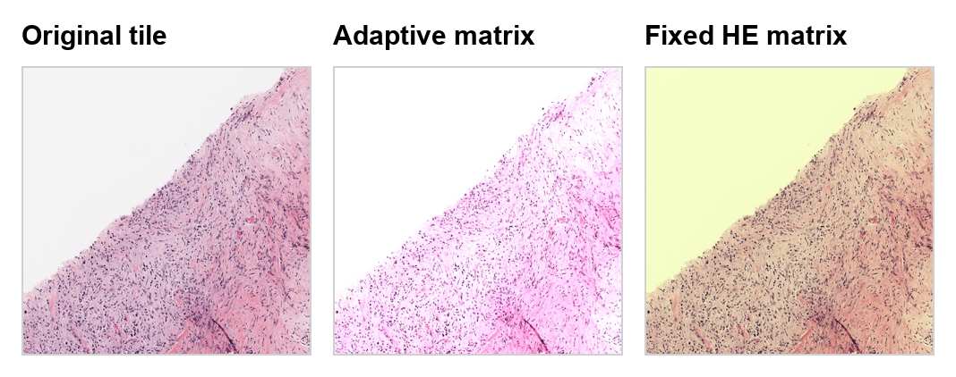 Stain augmentation variants from the bundled demo slide