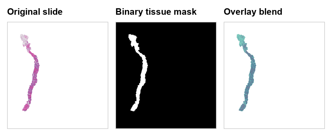 Bundled tissue mask demo triptych